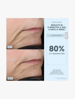 NuFACE Trinity® Complete Facial Toning Kit - NuFACE | MECCA