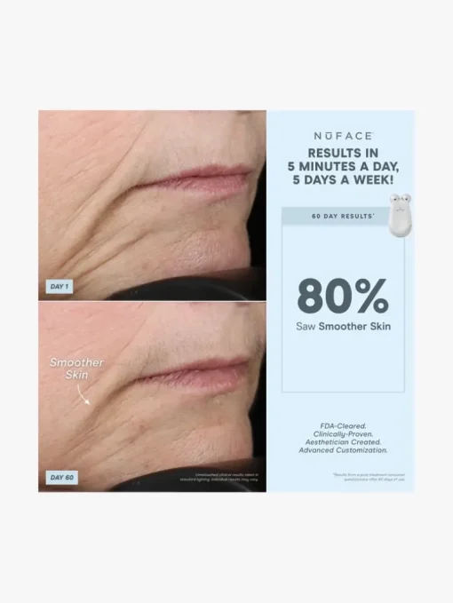 NuFACE Trinity® Complete Facial Toning Kit - NuFACE | MECCA