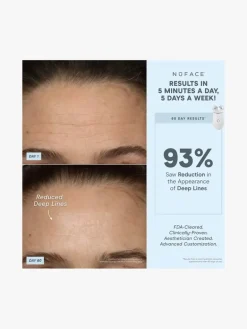 NuFACE Trinity+® Starter Kit | MECCA
