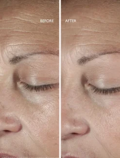 Omorovicza Queen Serum | MECCA