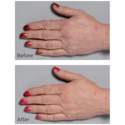 Perricone MD Cold Plasma Plus + Hand Therapy | MECCA