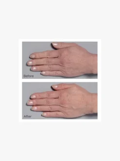 Perricone MD Cold Plasma Plus + Hand Therapy | MECCA