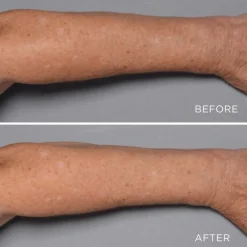 Perricone MD Cold Plasma Plus+ Fragile Skin Therapy | MECCA