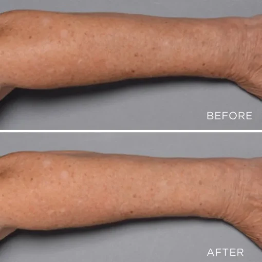 Perricone MD Cold Plasma Plus+ Fragile Skin Therapy | MECCA