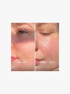 REN Clean Skincare Evercalm Repair Complex | MECCA