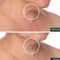 RéVive Fermitif Neck Renewal Serum Firming Treatment | MECCA