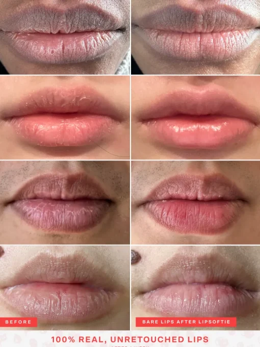 Tower 28 LipSoftie Rescue Lip Treatment | MECCA